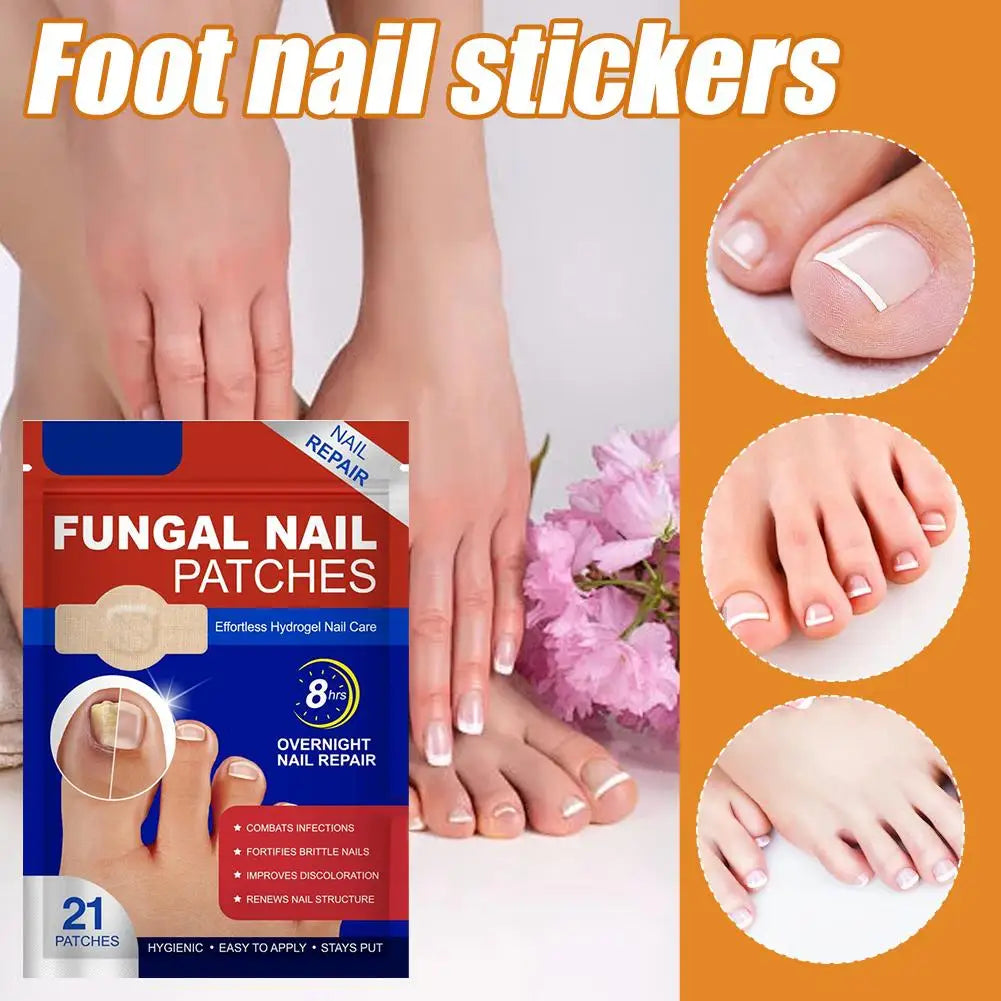 Toe Fungus Patch – Restore the Beauty of Your Nails Effortlessly!