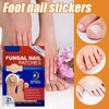 Toe Fungus Patch – Restore the Beauty of Your Nails Effortlessly!