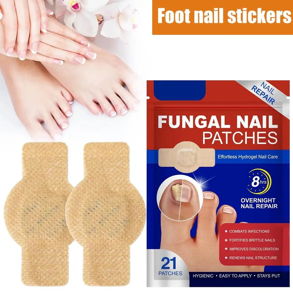 Toe Fungus Patch – Restore the Beauty of Your Nails Effortlessly!