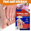 Toe Fungus Patch – Restore the Beauty of Your Nails Effortlessly!
