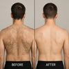 BackBlade Pro™ Effortless Back & Body Shaving